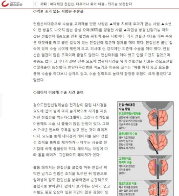 비대해진 전립선, 태우거나 묶어 해결… 性기능 보존한다